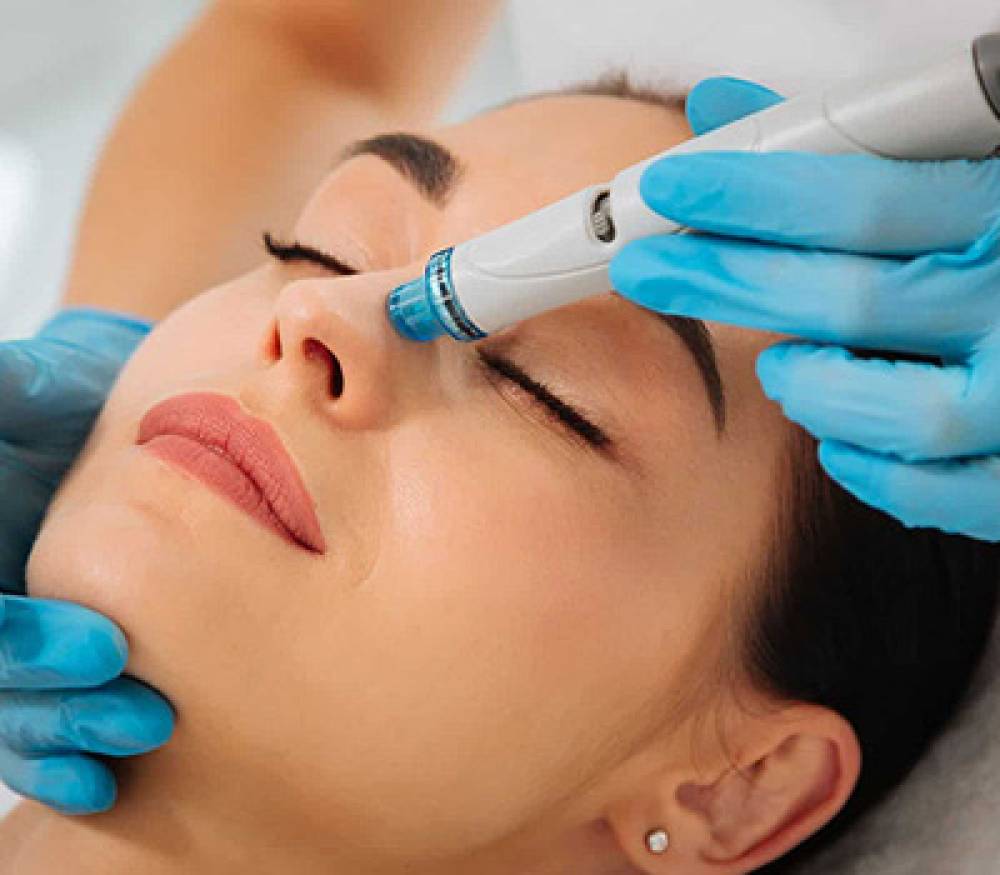 hydradermabrasion