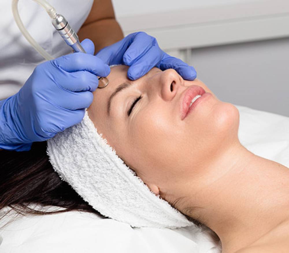 Microdermabrasion