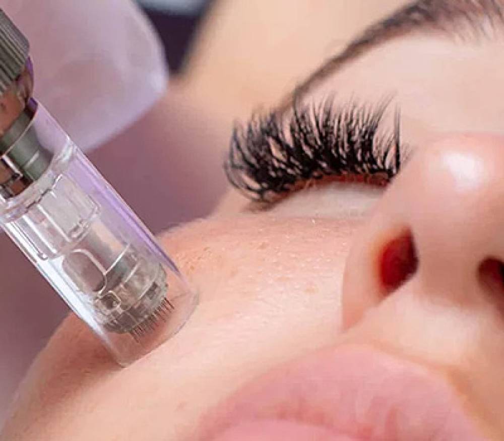 Microneedling Course