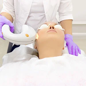 Close up of microneedling treatment