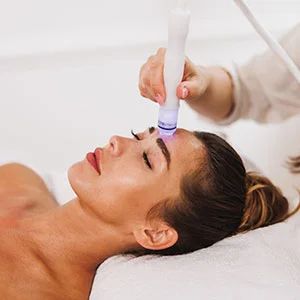 Close up of microneedling treatment