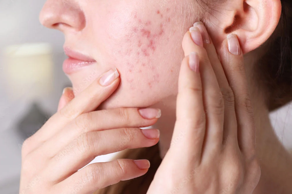 Woman receiving facial treatment