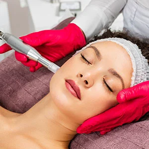 Close up of microneedling treatment