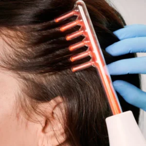 Close up of microneedling treatment