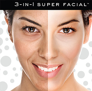 Close up of microneedling treatment