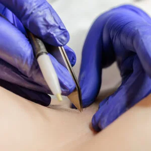 Woman receiving facial treatment