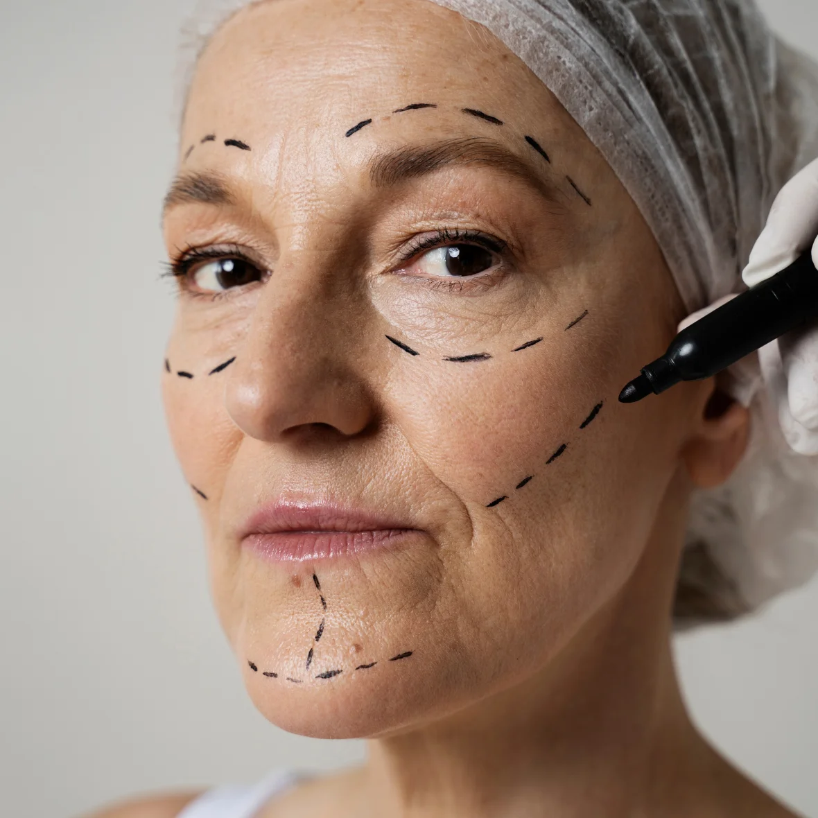 After facial treatment