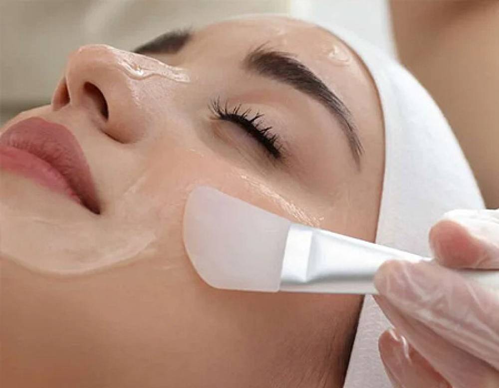 Chemical Peels