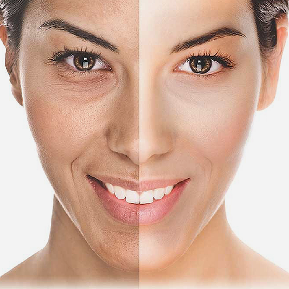 Oxygeneo Classic Facial