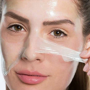 Chemical Peel